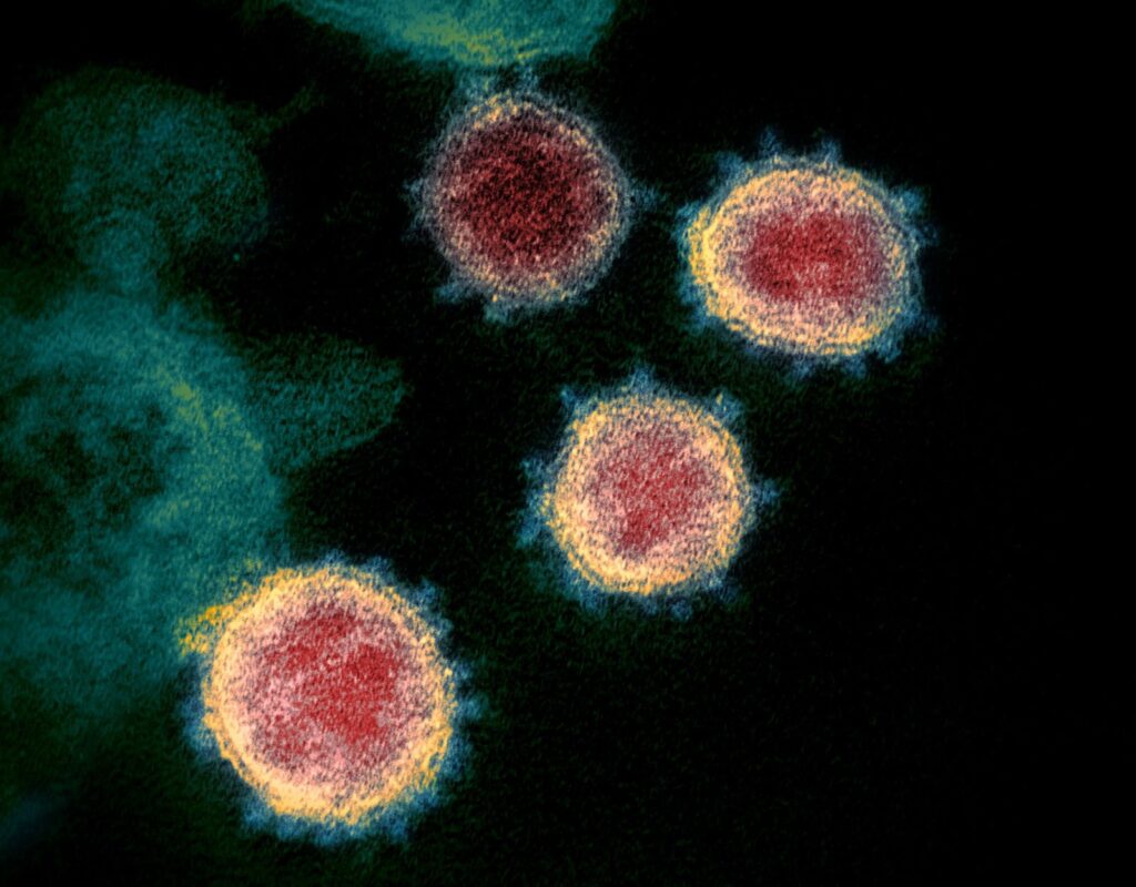 Santa Catarina confirma mais sete casos da variante brasileira do coronavirus