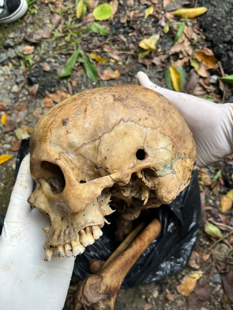 Crânio humano encontrado em matagal na interprais